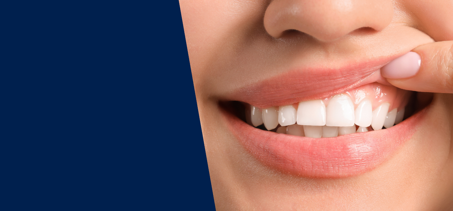 Gum disease treatment|Periodontics