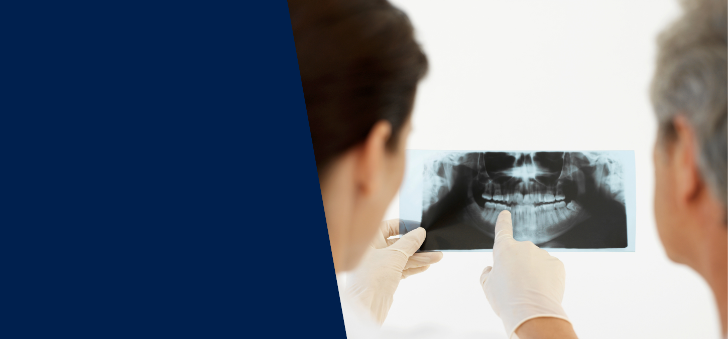 X-rays |Oral Radiology